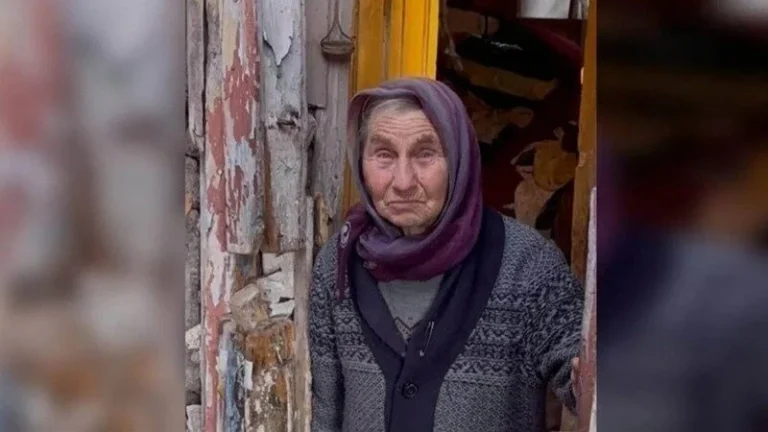 Köpekleri Besledi, Yanarak Öldü!